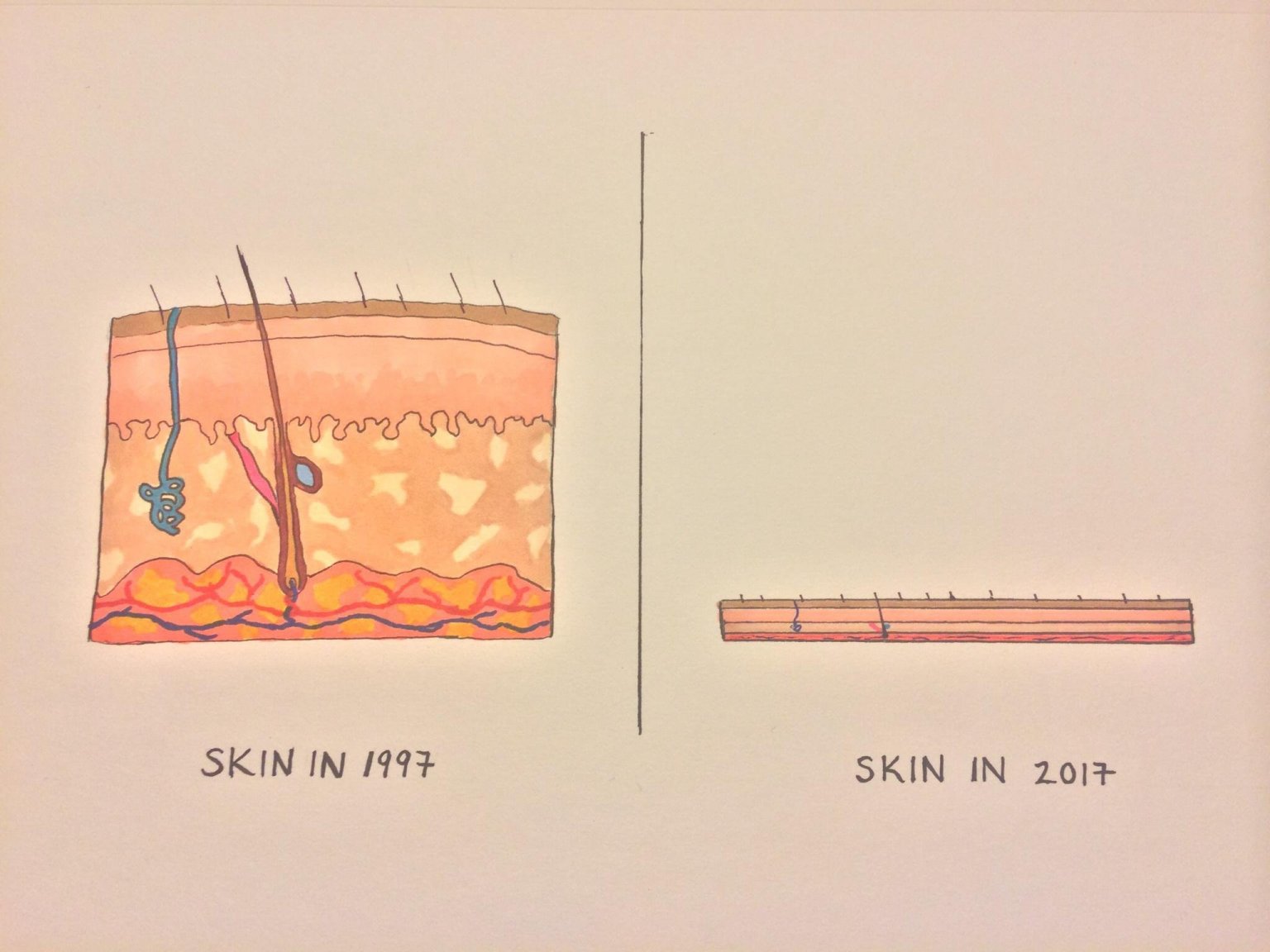 ThickerSkin.thumb.jpg.06dba3182a537cb8f8234ec650f34a5e.jpg