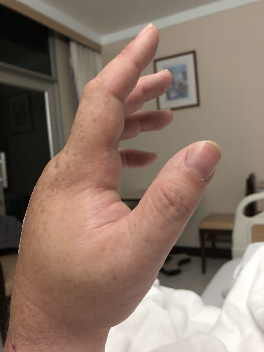 hand.thumb.jpg.c84aeb6aaf5d00ff47a27f1bfbf6331c.jpg