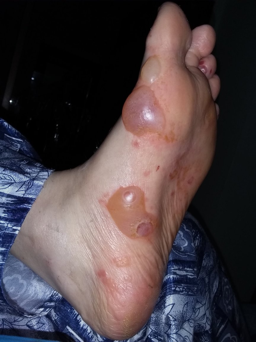 20190319_024850.thumb.jpg.d36074e989459356e09da6613afb0467.jpg