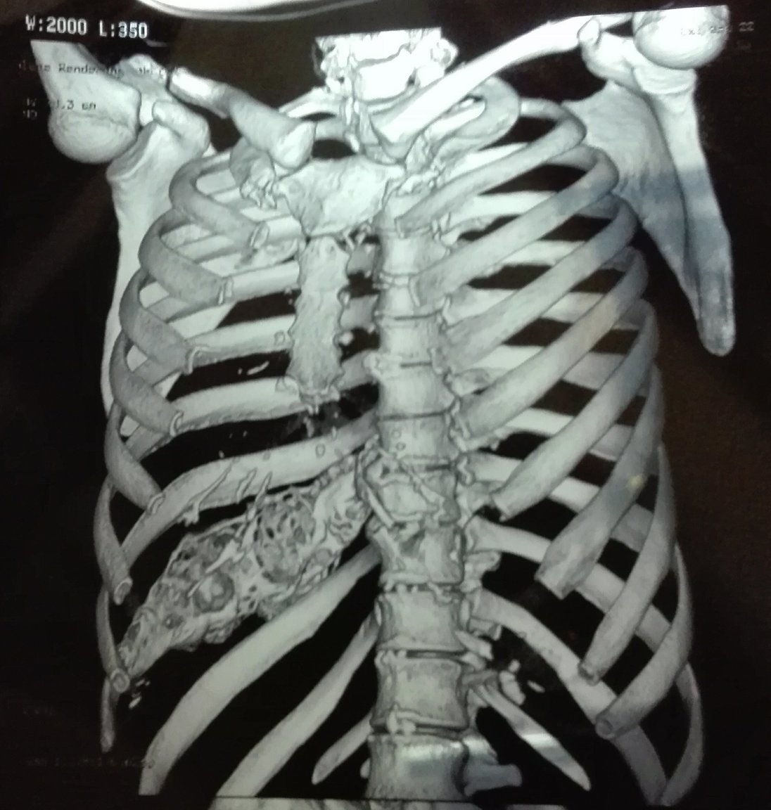 CT Scan Pics (2).jpg
