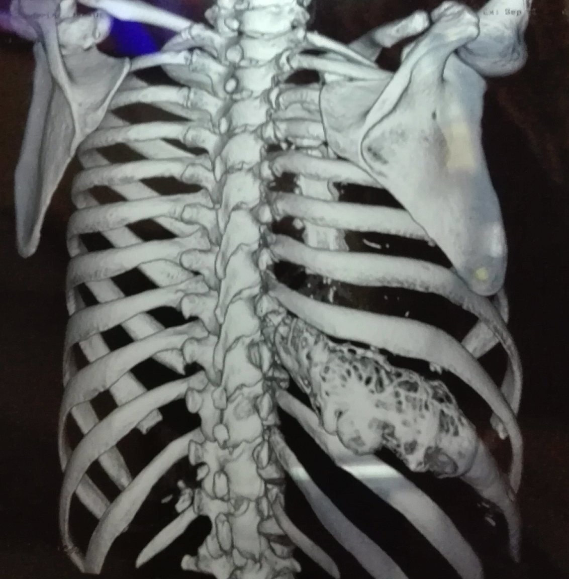 CT Scan Pics (5).jpg