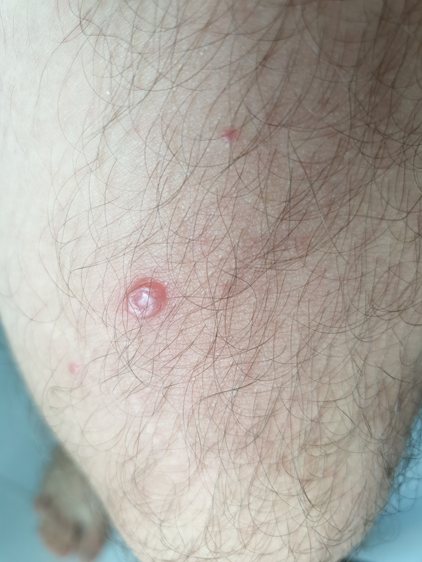 Rash - Does anyone know what it could be? Any recommendations for a ...