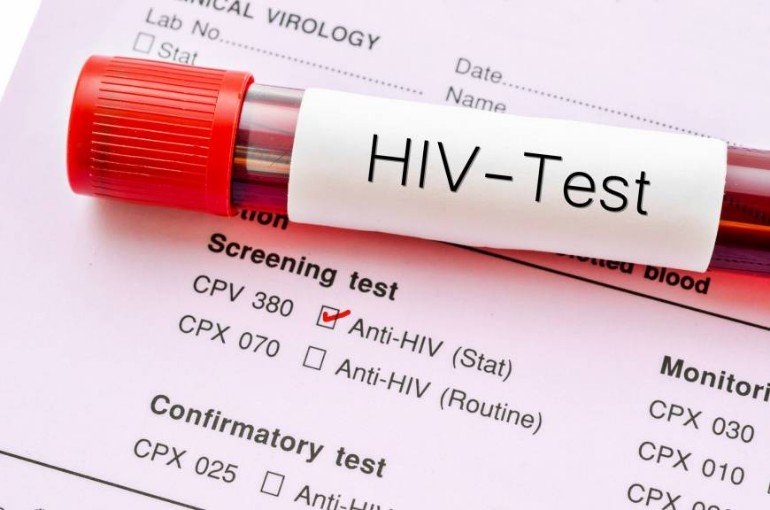 n-hiv-a-20171031-870x576.jpg