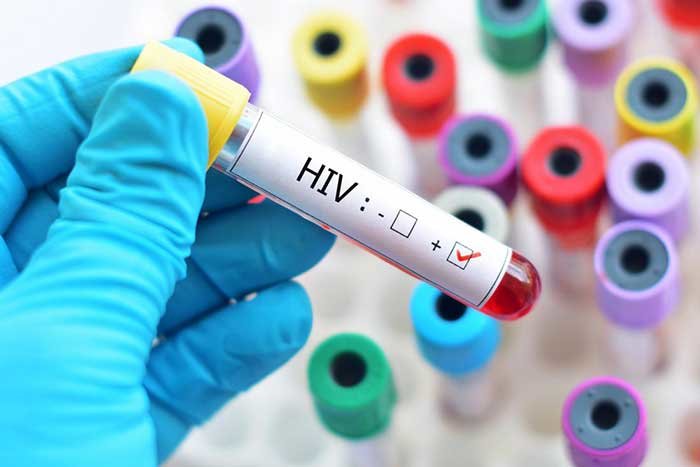 hiv.jpg