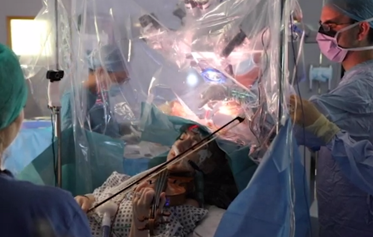 datgmar-turner-playing-the-violin-during-brain-surgery.png