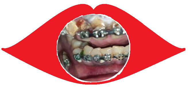 image.png.c48407a89659c696bf0bf1f7219cea0f.png