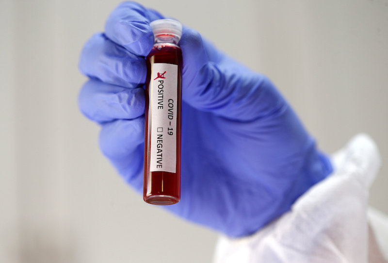 2020-04-04T093928Z_7_LYNXMPEG320ER_RTROPTP_4_HEALTH-CORONAVIRUS-USA-TREATMENTS.JPG