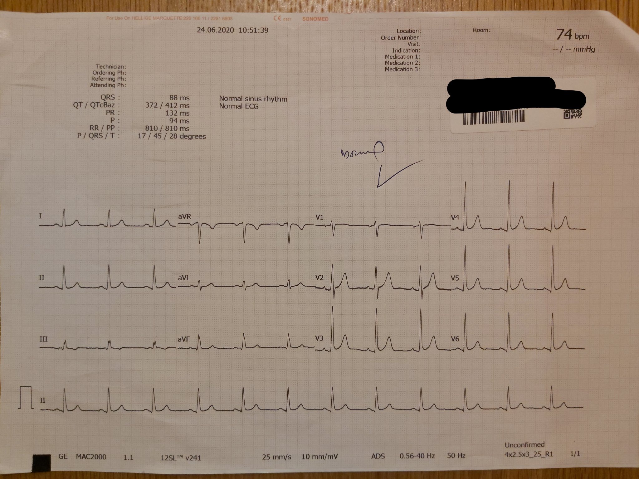 ECG1.jpg