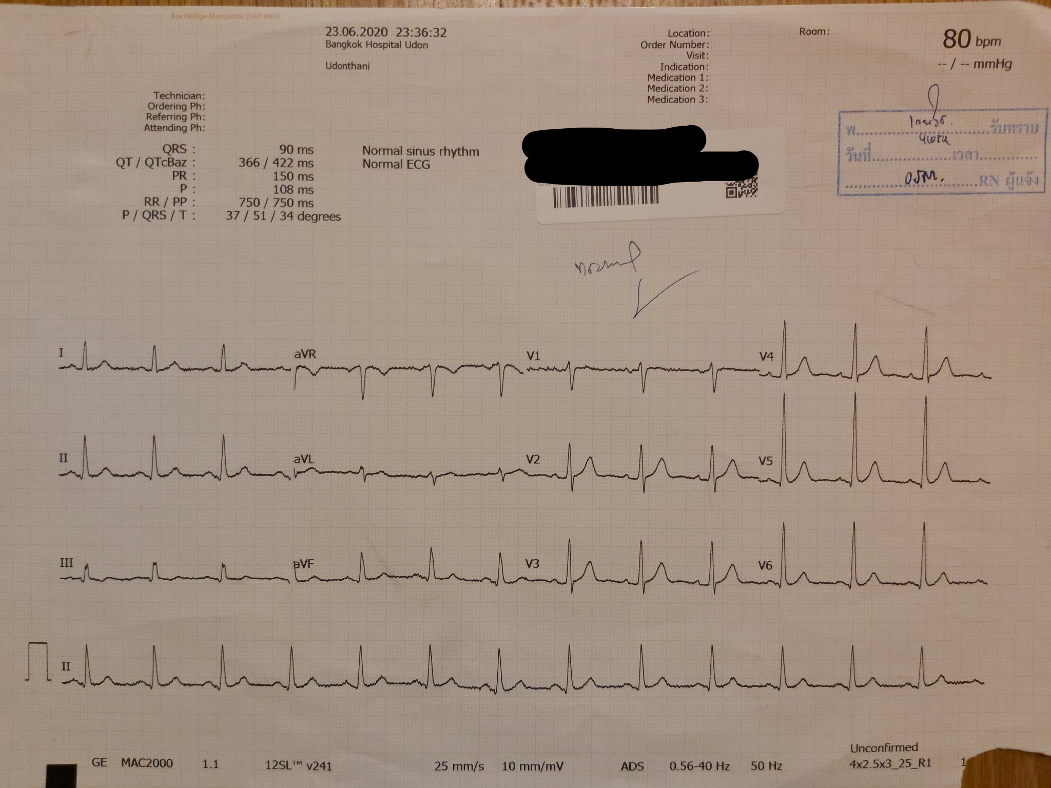 ECG2.jpg