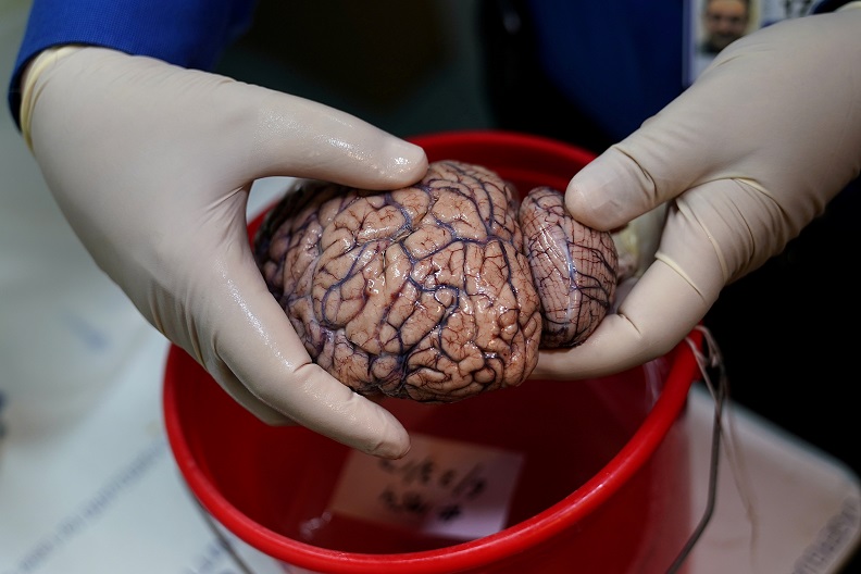 2020-10-27T124307Z_1_LYNXMPEG9Q163_RTROPTP_4_HEALTH-CORONAVIRUS-BRAINS.JPG