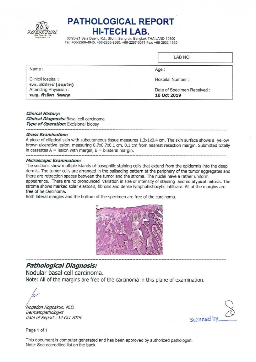527733206_SkinCancerBiopsyRedacted.thumb.jpg.5b1692198ec14071705ea76c536408a4.jpg