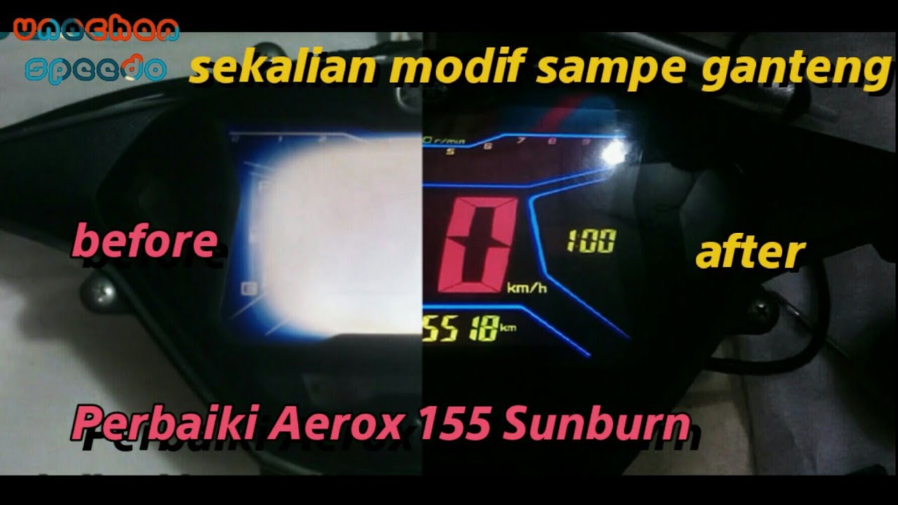 sunburn.jpg