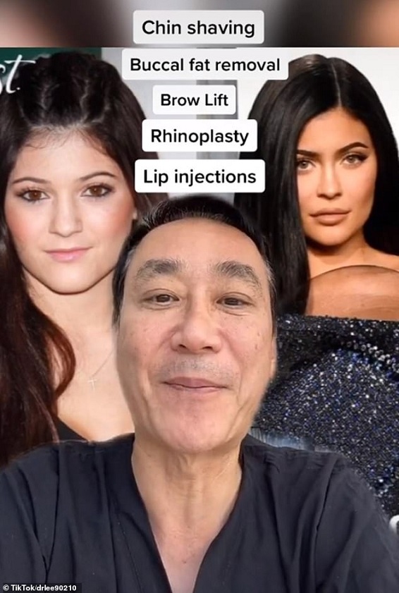 39362940-9266417-Surprise_Beverly_Hills_plastic_surgeon_Dr_Charles_S_Lee_is_expos-m-19_1613503305489.jpg