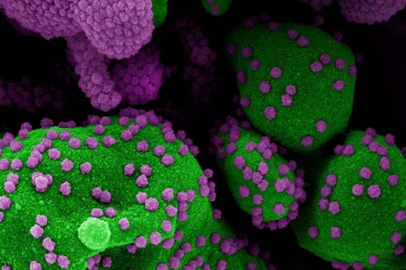 samples-sars-cov-2_2021-09-03_17-09-24.jpg