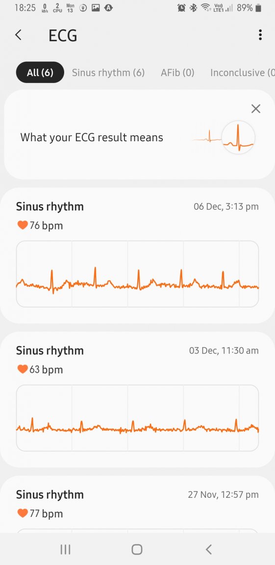 Screenshot_20211213-182558_Samsung Health Monitor.jpg