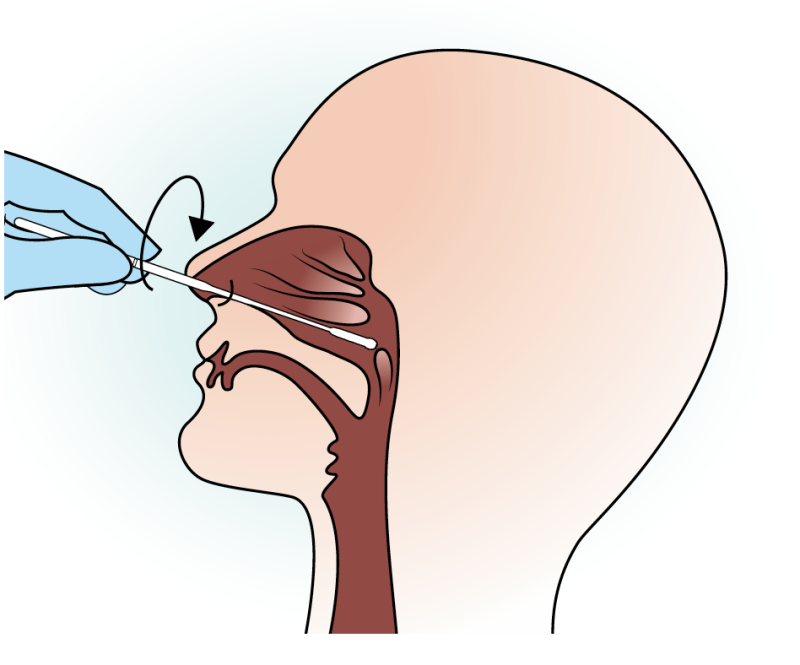 1920667161_swab-nasaopharyngeal.png.b01defb0f94c0459108a3ac64730c85c.png