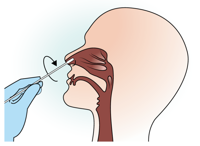 467327412_swab-nasal.png.ce3afddc1005b1a687c0a4b41c5ce11a.png