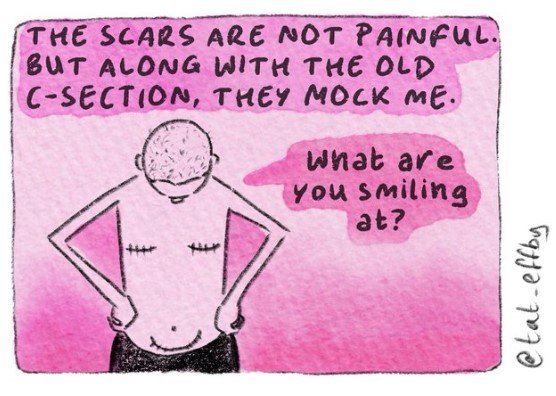 Scars.jpg.14a5e7723fc2beea26f3080d6e020ffb.jpg