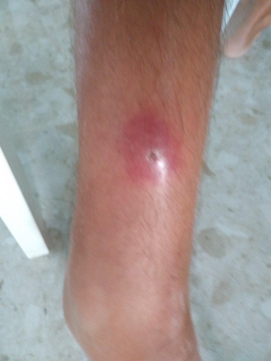 thing on leg.jpg