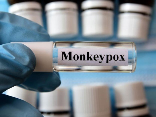 10th Case Of Monkeypox Infection Reported In Singapore - Singapore News 