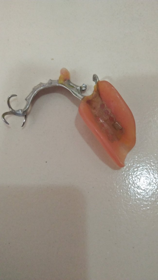 denture.jpg