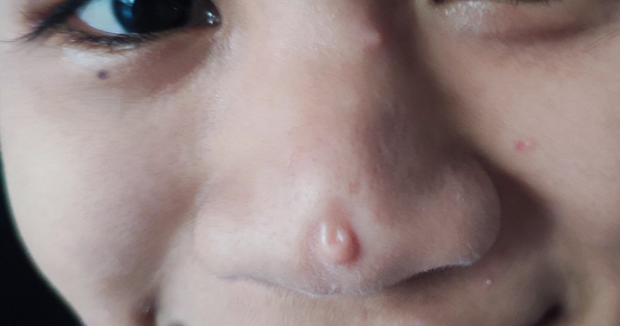 Nose IMG_20230409_174045.jpg