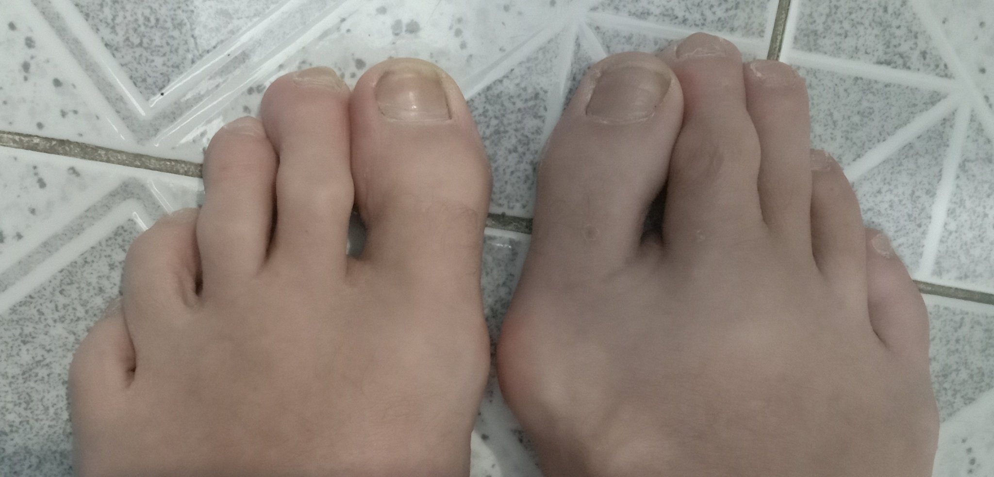 toes.thumb.jpg.661a04693edb2f41df3bc053b18f5a3e.jpg