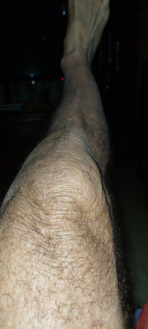 20240221_050843.thumb.jpg.37267fd59ba564c0834cac881aea401b.jpg