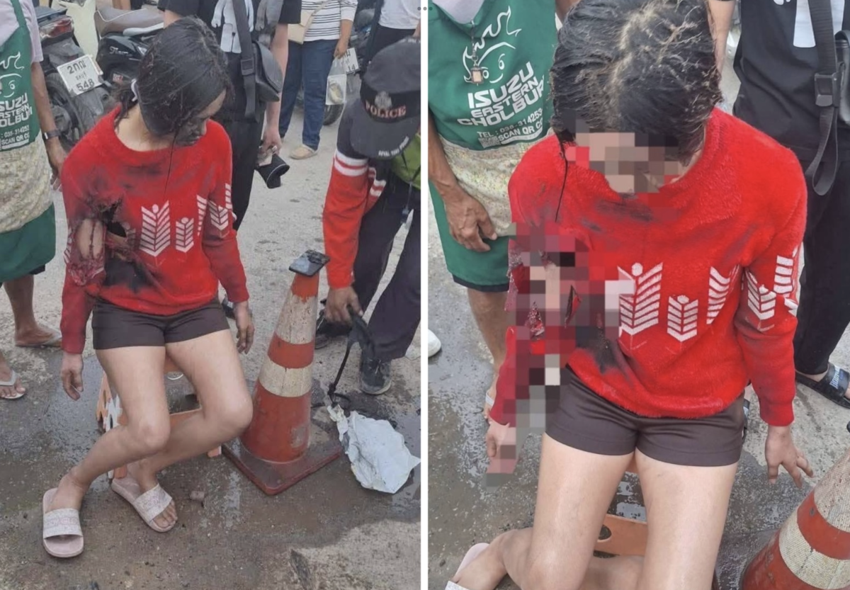 Power Bank Explodes in Bag, Injuring 22-Year-Old Woman