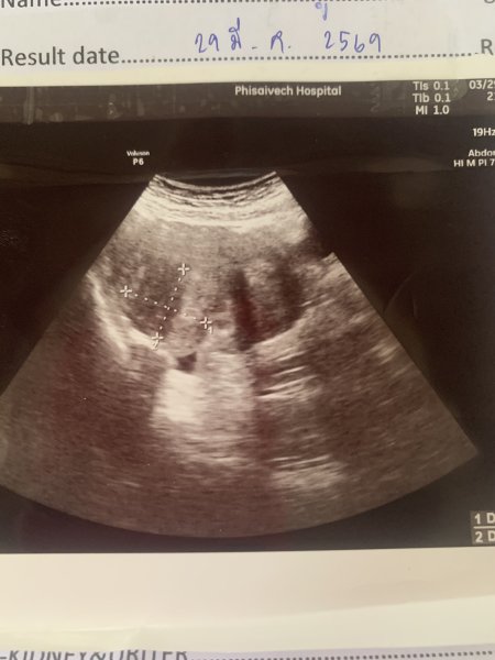 Advise about what Hospital Udon Thani