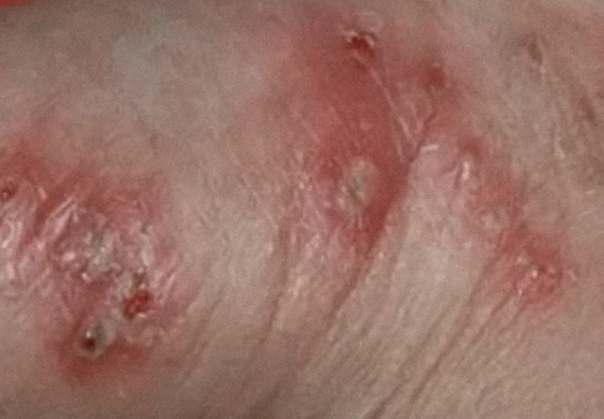 image.png.14e950fe48e433d22fda6c60ff1fa633.png