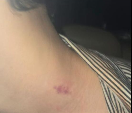 neck.png