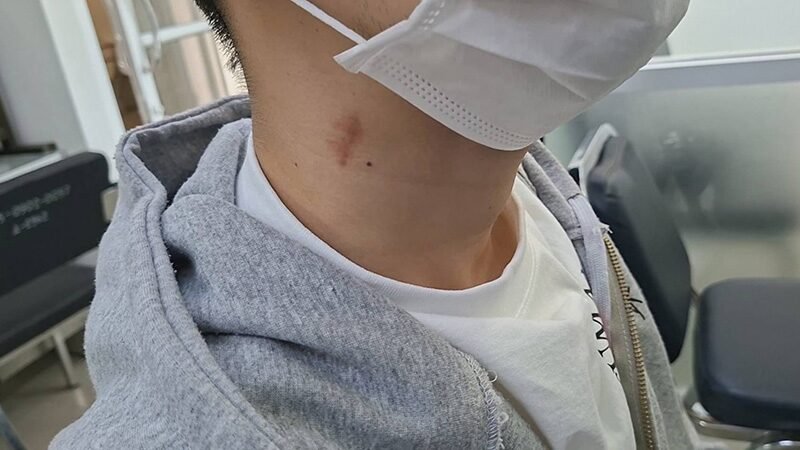 neck3.jpg