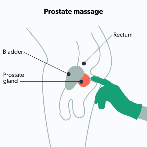 Prostatic   Massage