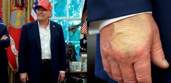 Trump’s Makeup-Slathered Hand Gets Up-Close Treatment