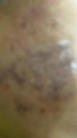 post-14561-1131627852_thumb.jpg