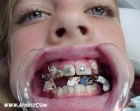 post-17974-1131204504_thumb.jpg
