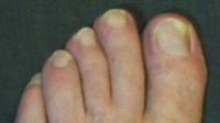 post-21141-1156926293_thumb.jpg